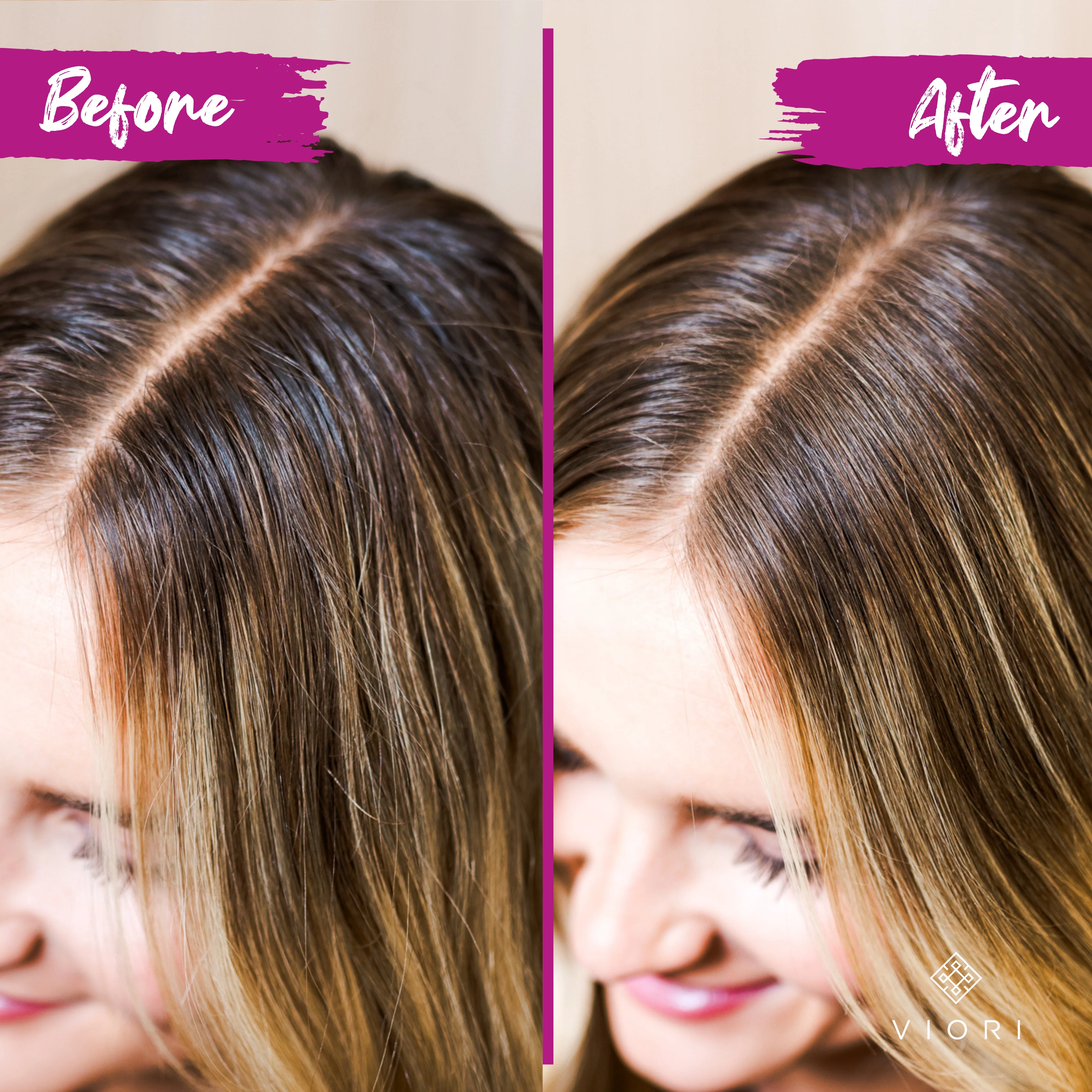 Magnolia & Peony Natural Dry Shampoo | VIORI - Image 3