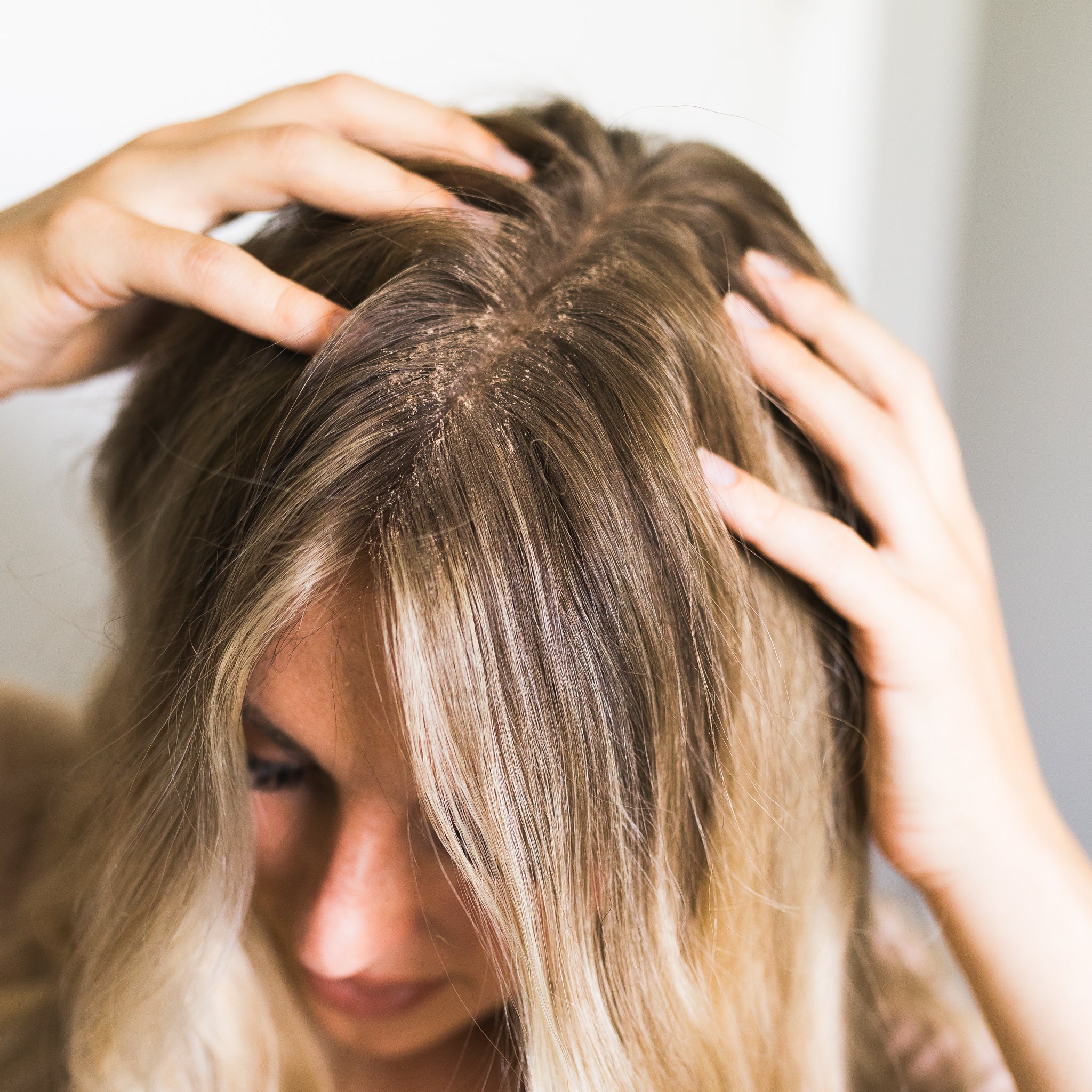 Magnolia & Peony Natural Dry Shampoo | VIORI - Image 6